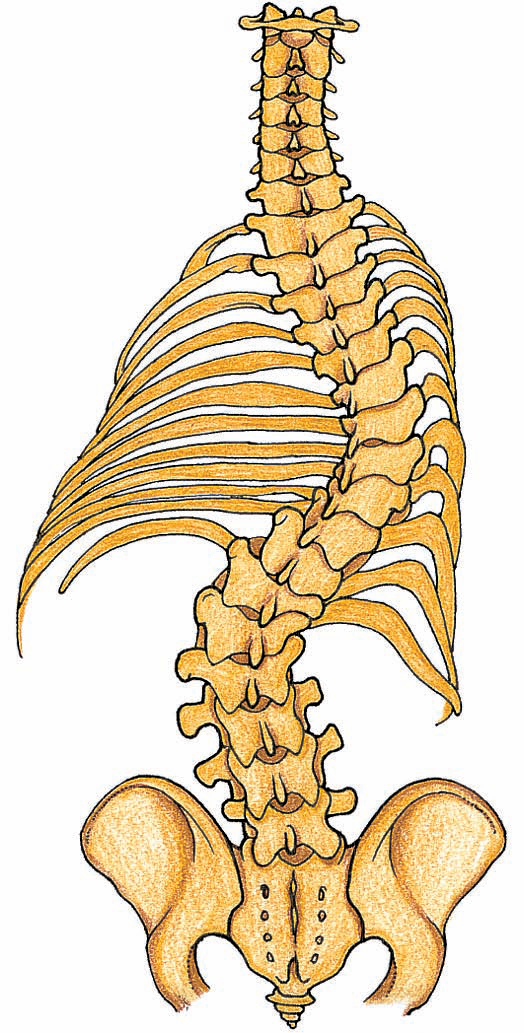 側彎症の解説図　洲本接骨院側彎症ページ用資料